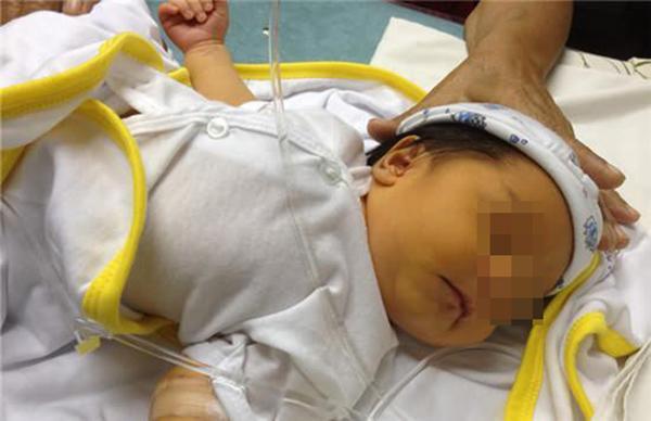 避免新生儿溶血免疫